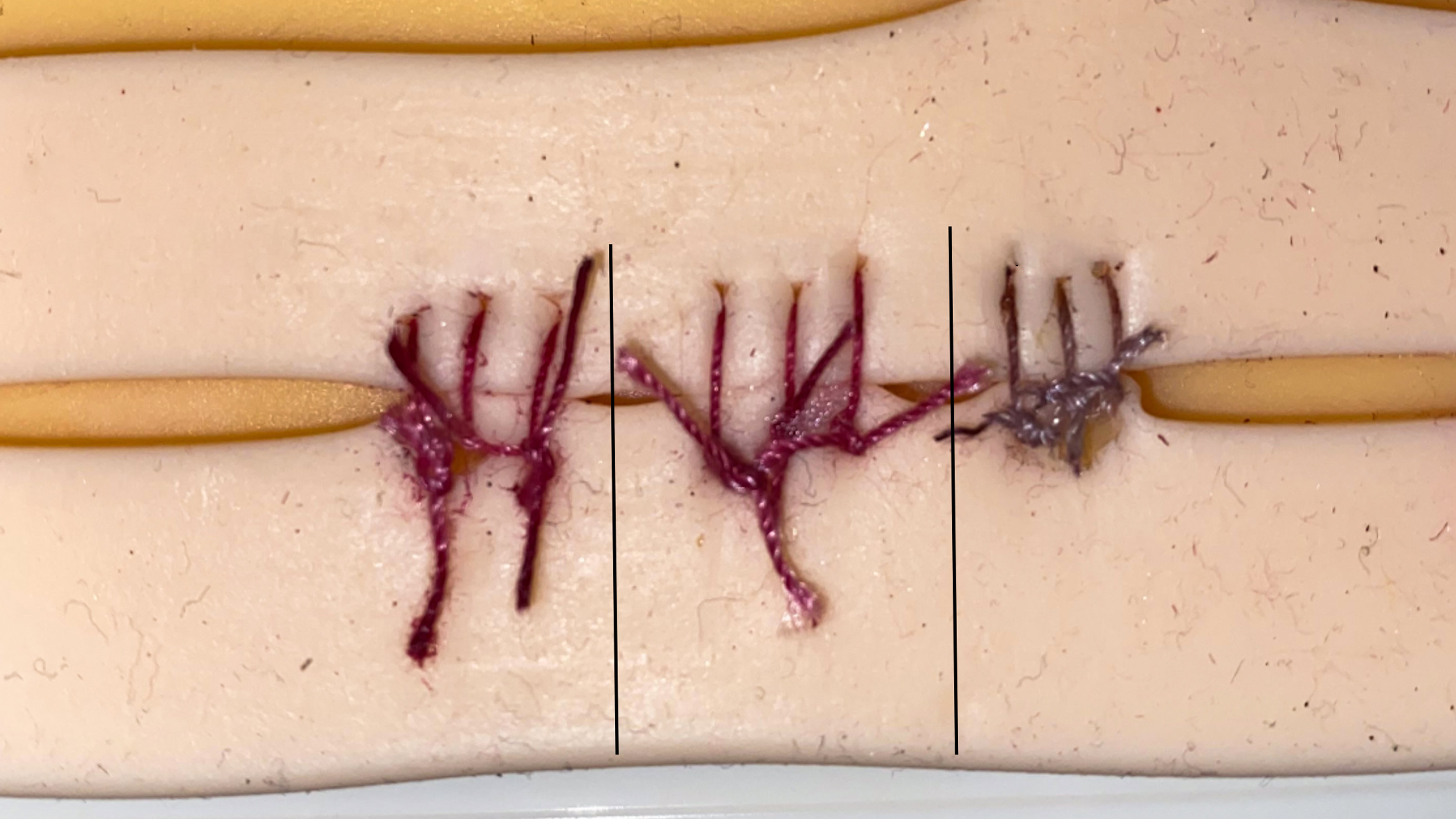 color-changing sutures