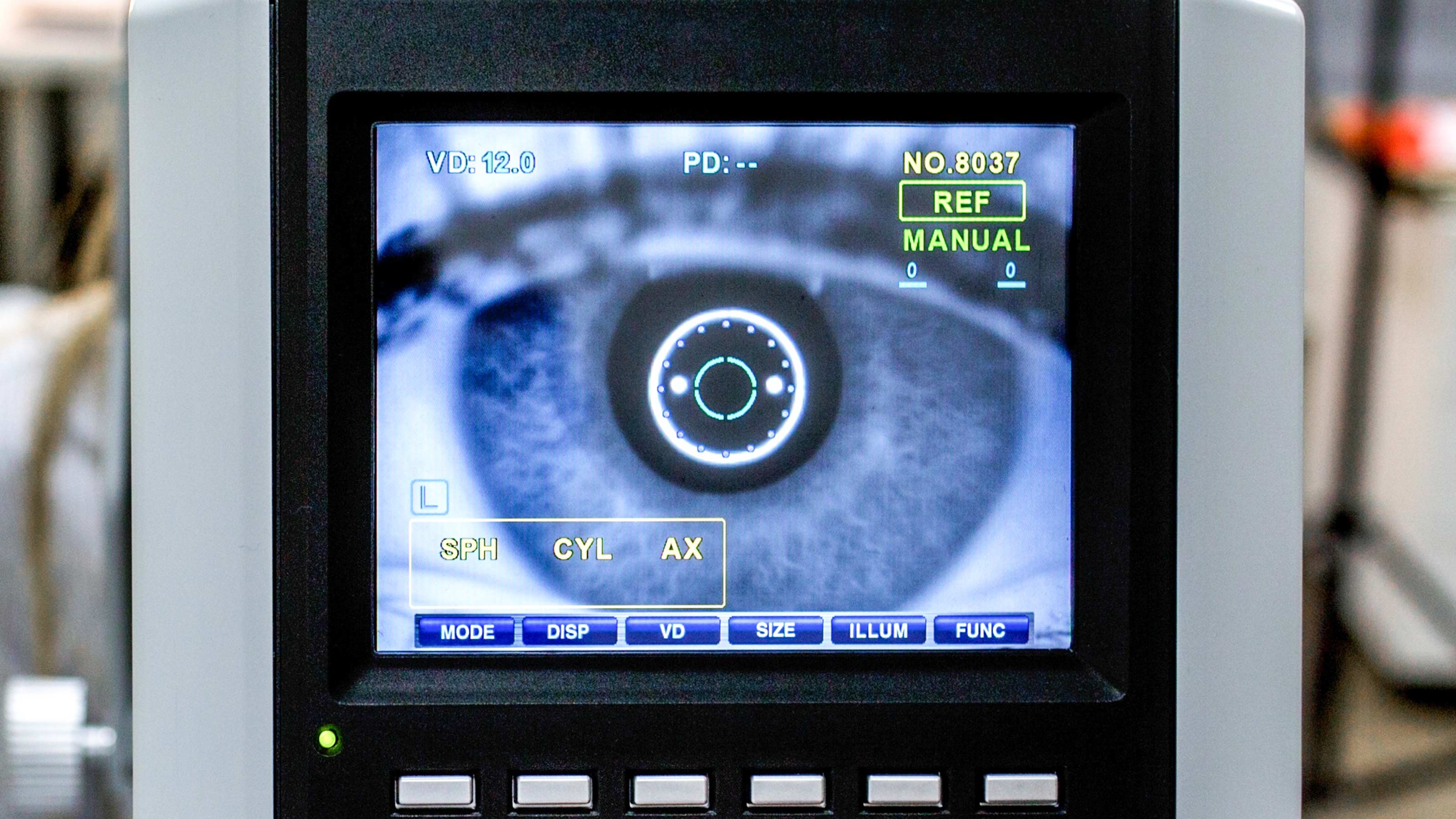 Dry Macular Degeneration