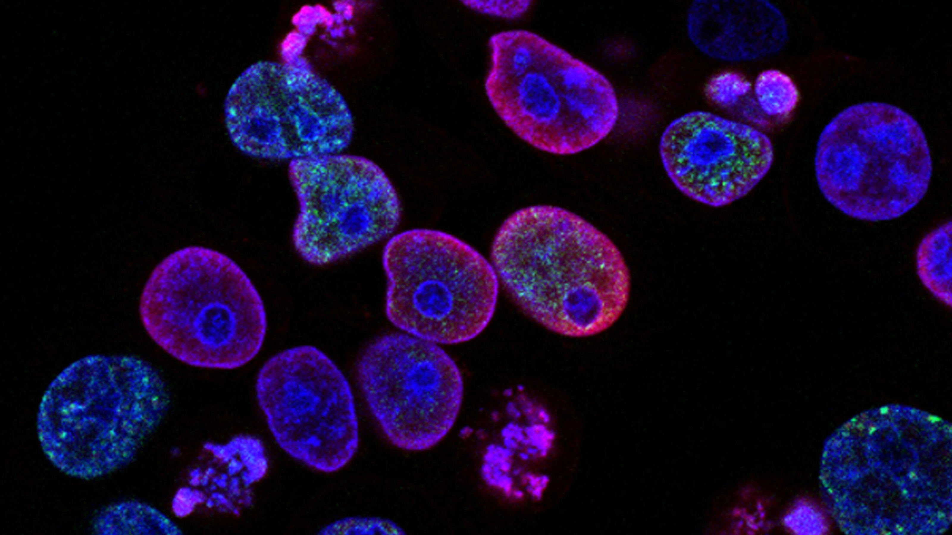 cancer cells hibernate
