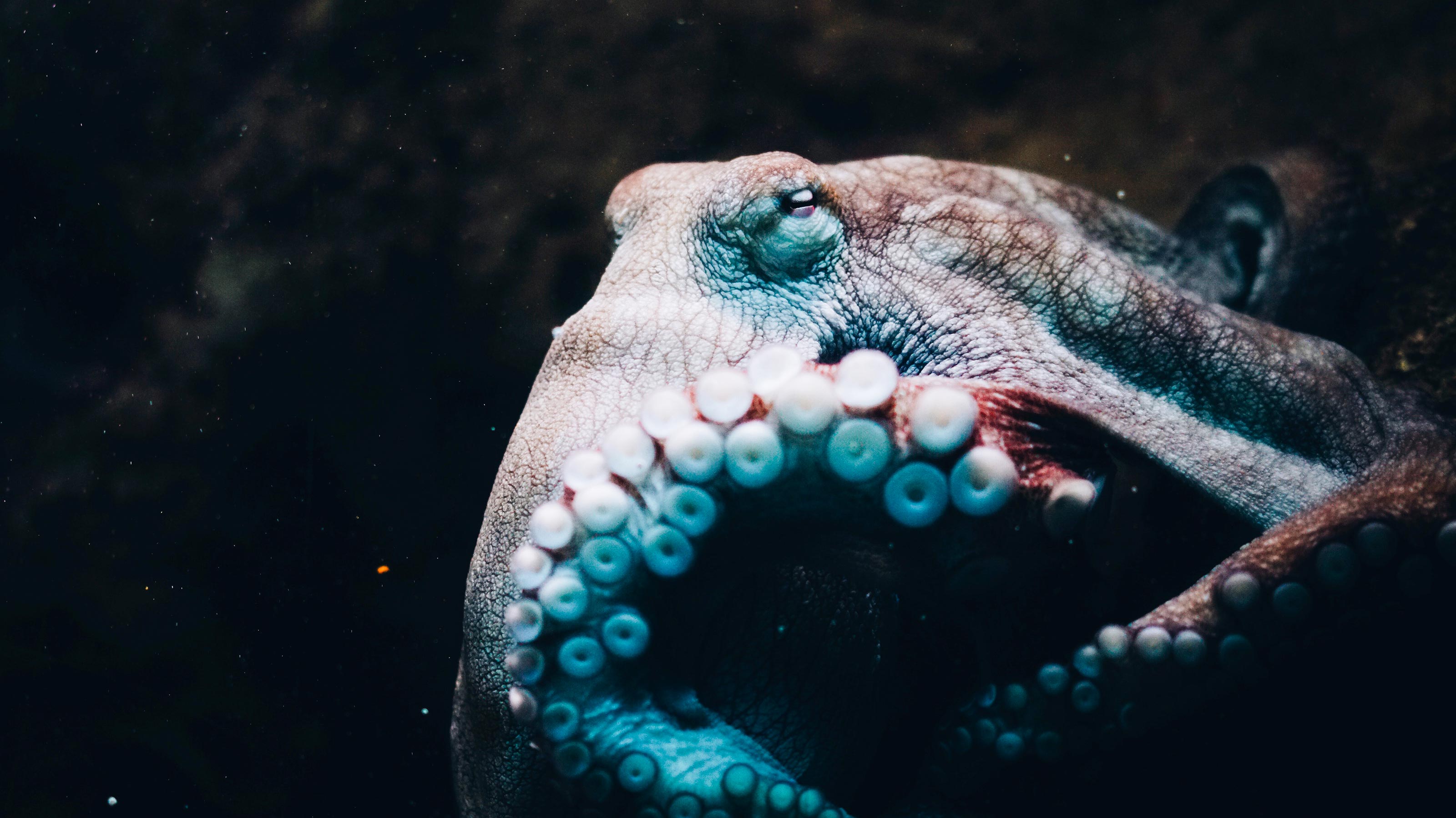 macular degeneration risk