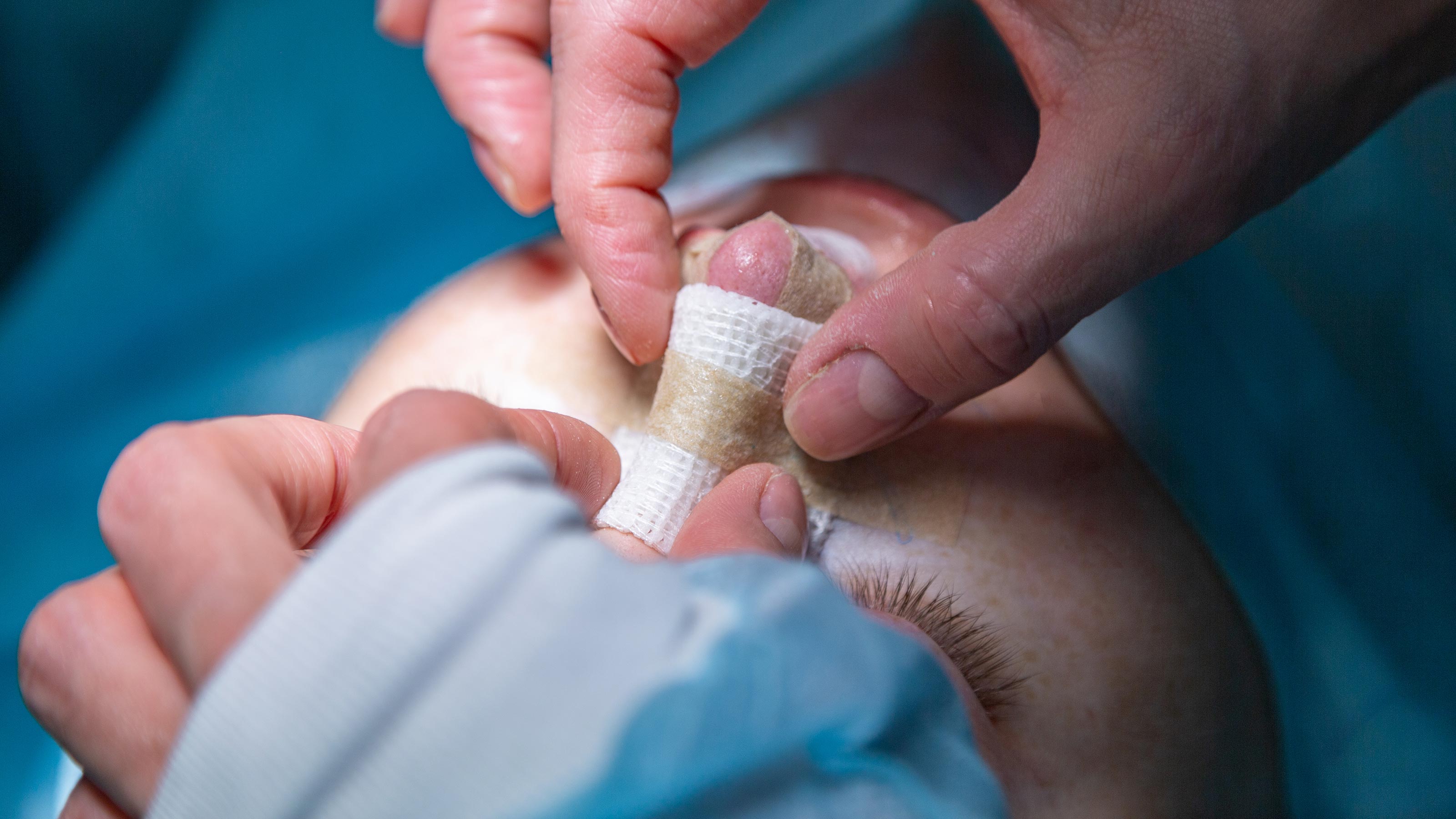 3d printed nose cartilage