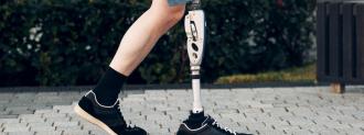 prosthetic limbs