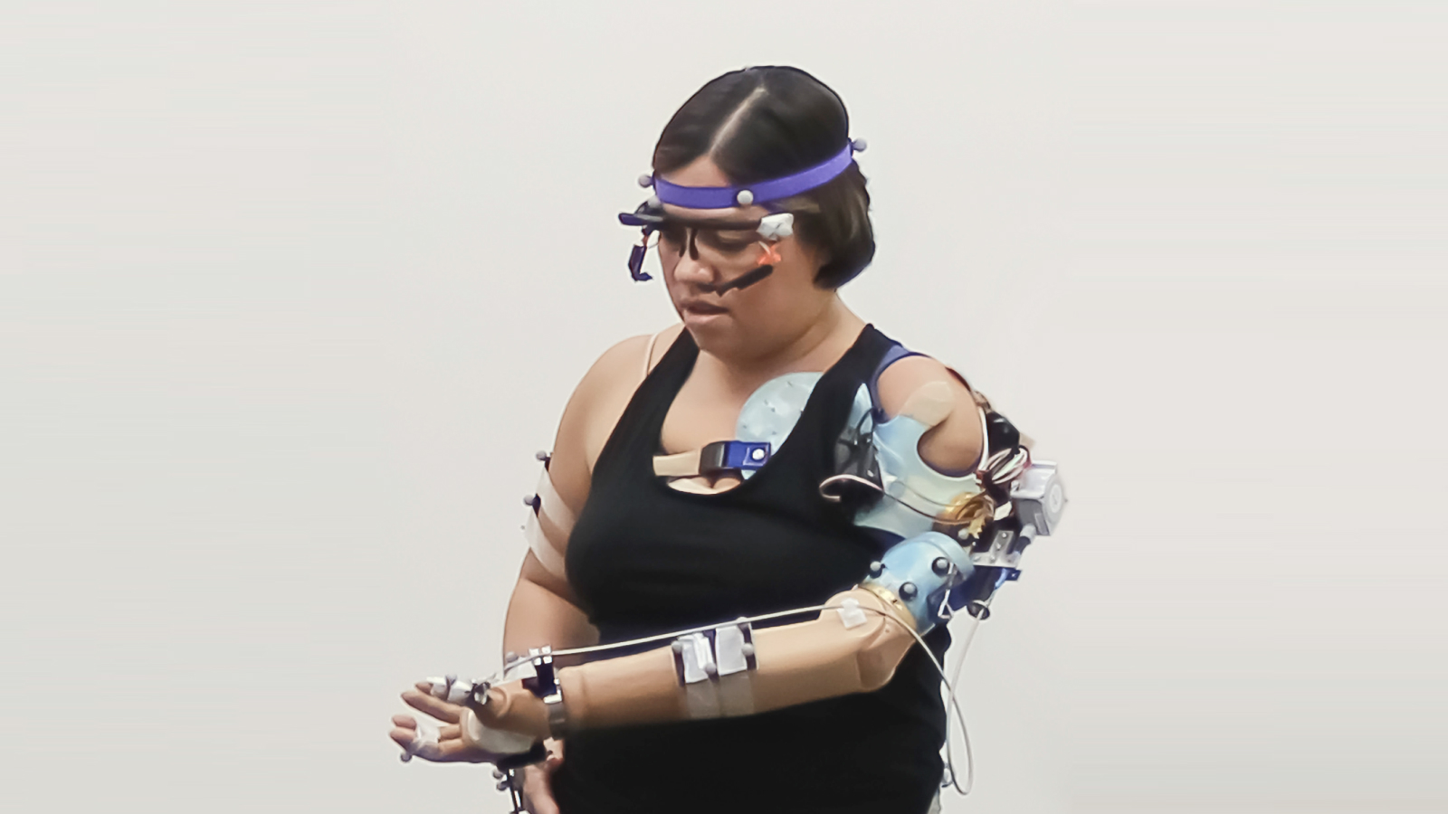 bionic arm