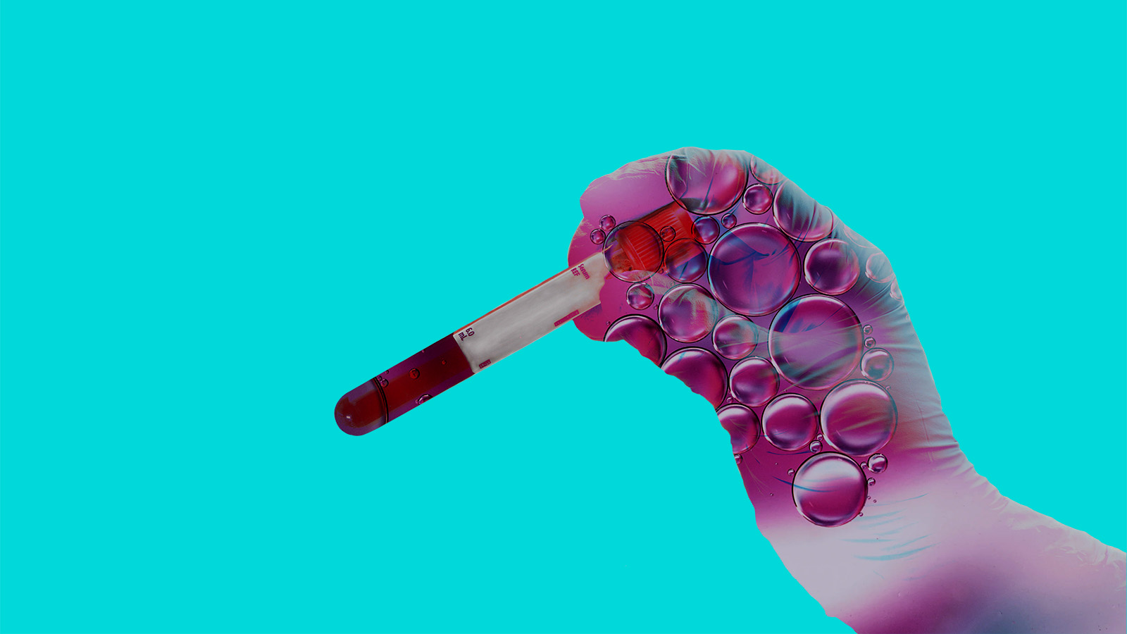 chances of getting HIV