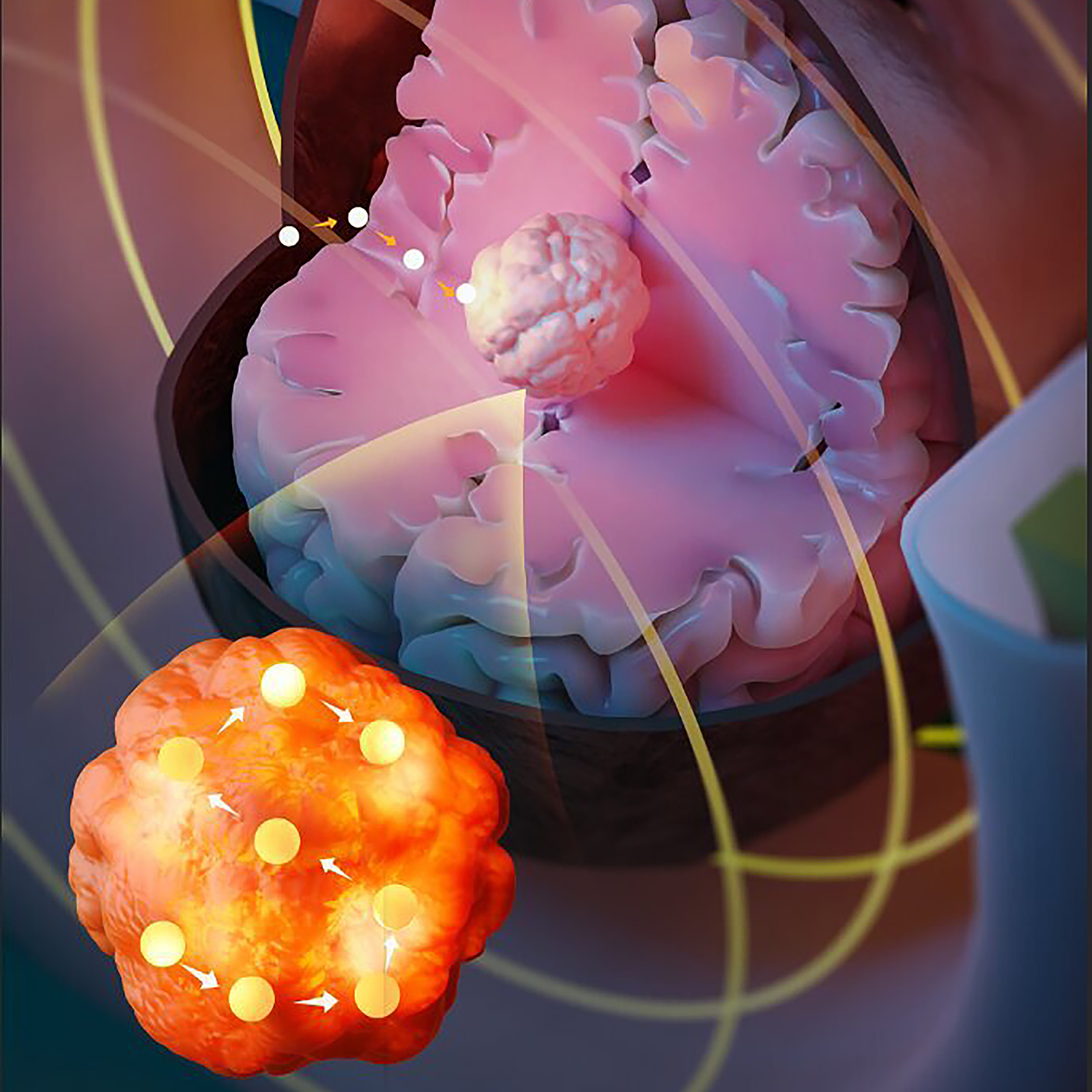 cancer therapy