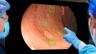 AI disease screening