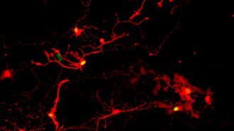 lab-grown eye cells