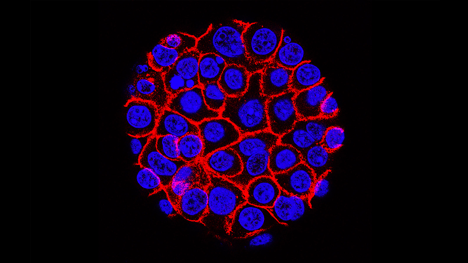 An image depicting cellular activity with blue and red lights, used for assessing the risk of pancreatic cancer.