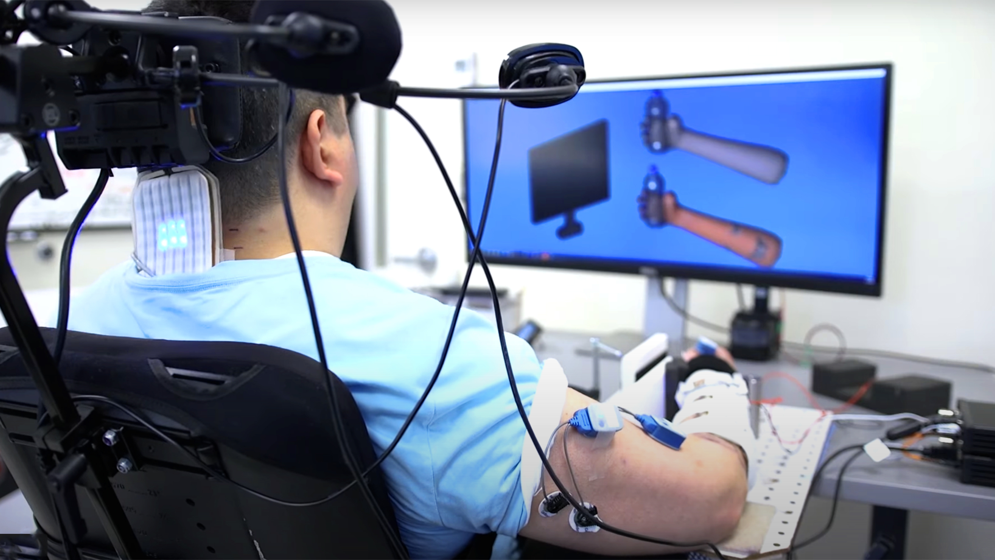 A quadriplegic man utilizing an AI-powered brain implant