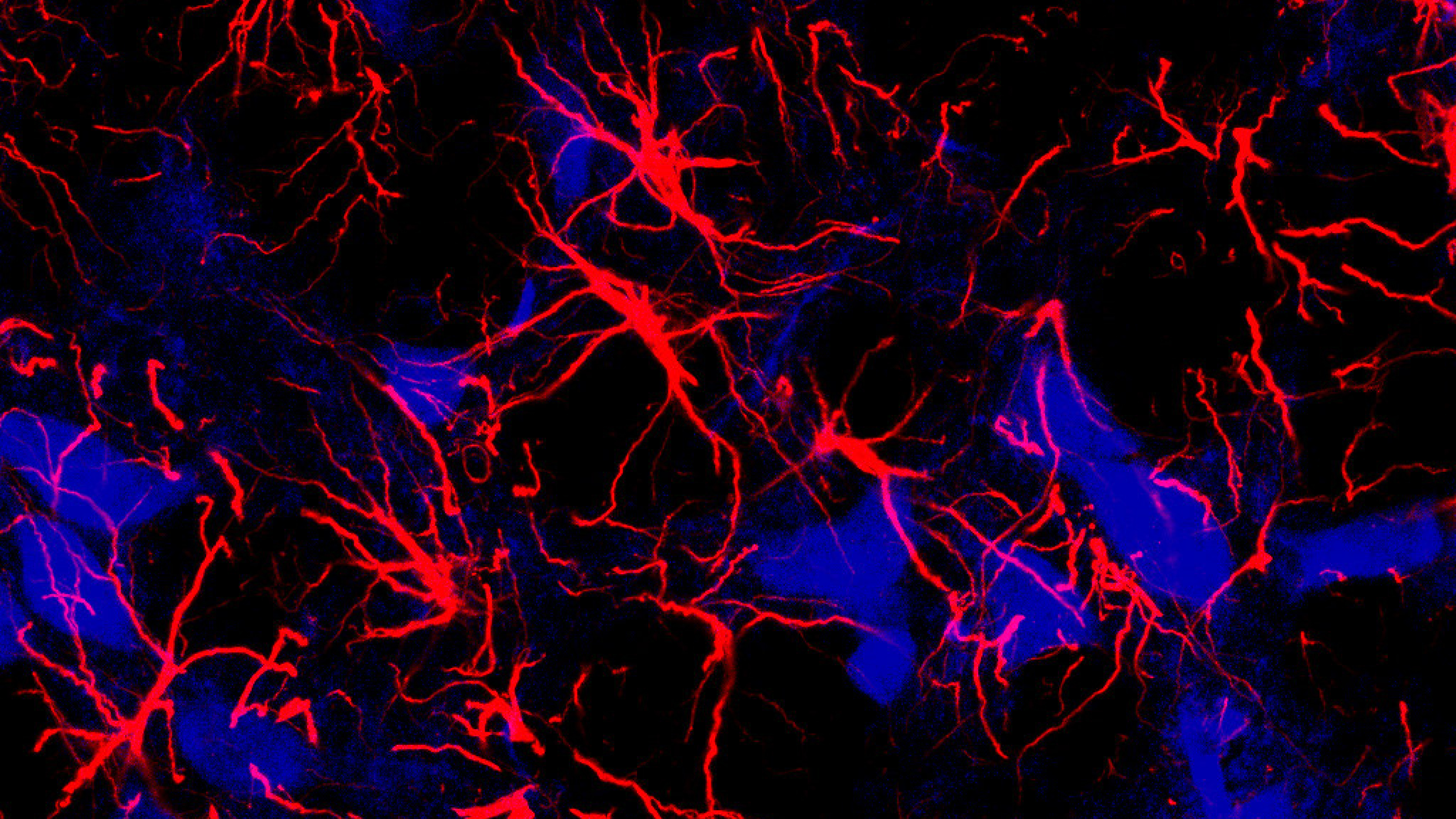 a close up of astrocytes, shown as red streaks, in the brains of mice