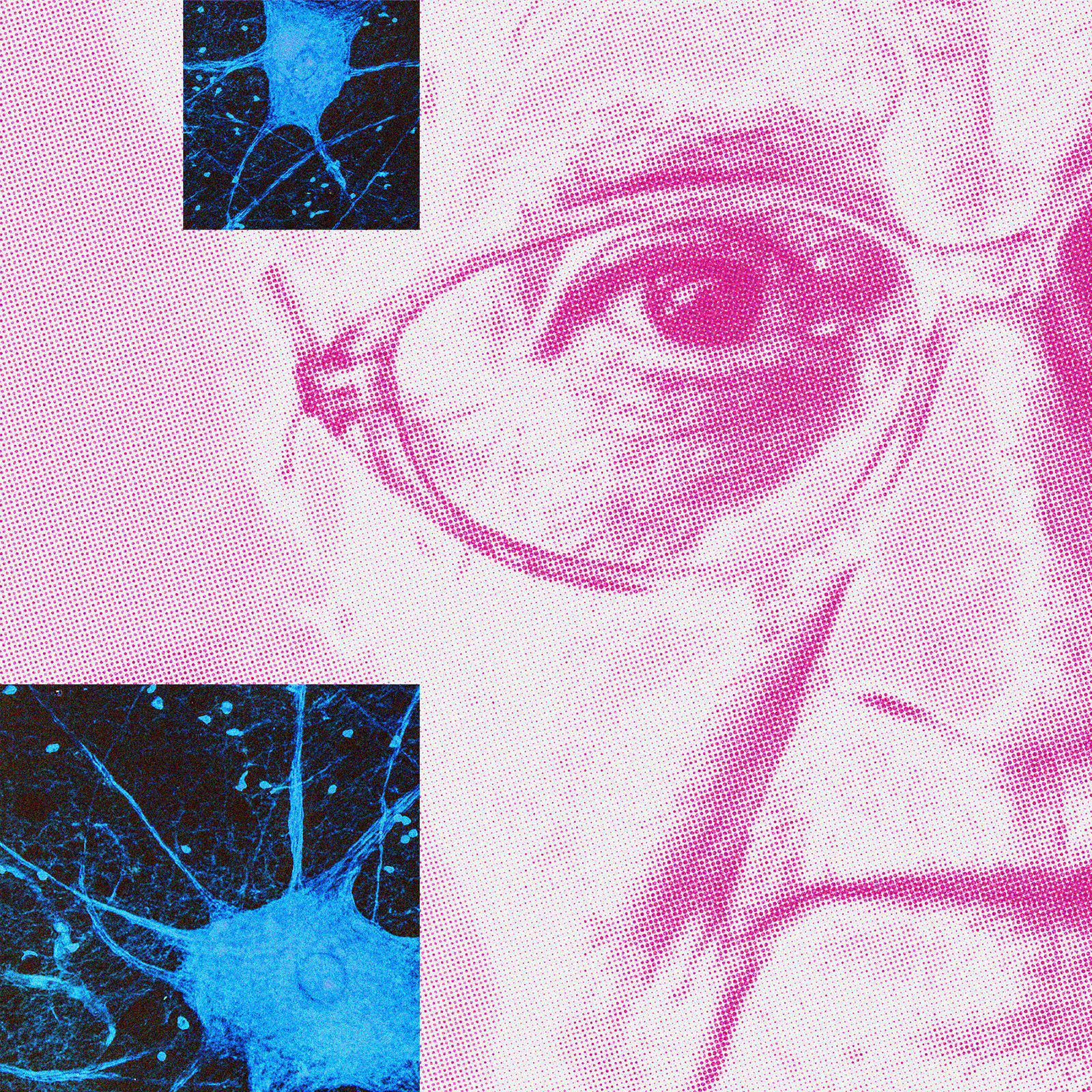 a collage of an older woman's face and brain neurons