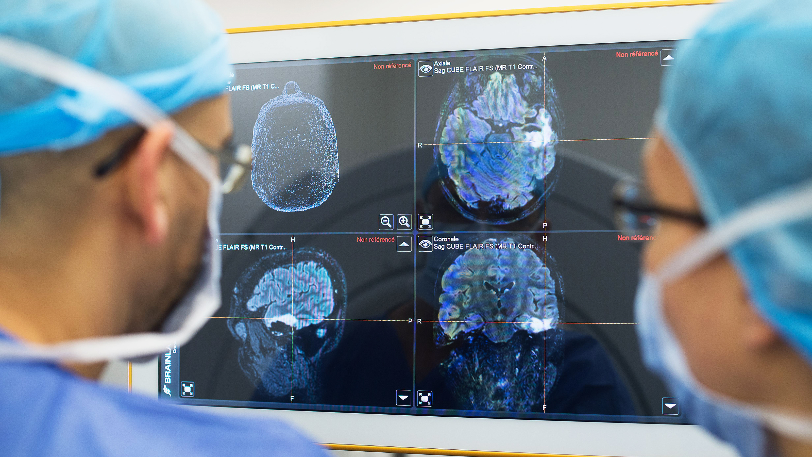 Surgeons analyzing brain images on a computer screen
