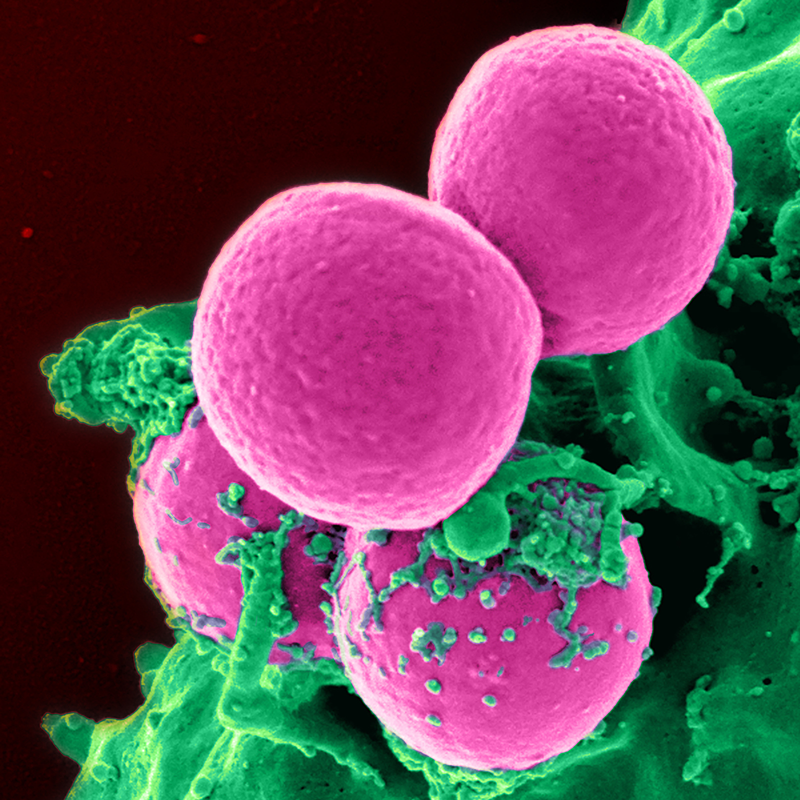a brightly colored microscope image of an immune cell ingesting MRSA