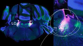 Two images of a brain with a green light and a purple light.