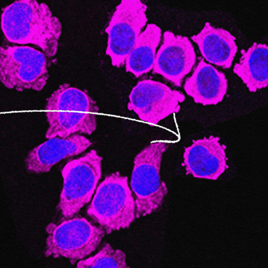 blue and purple cells
