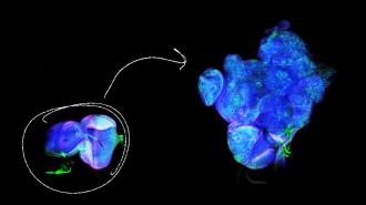 Fluorescent microscopy image showing cells in blue and green